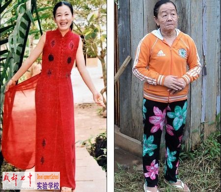 越南女子短短几日内妙龄变老妇